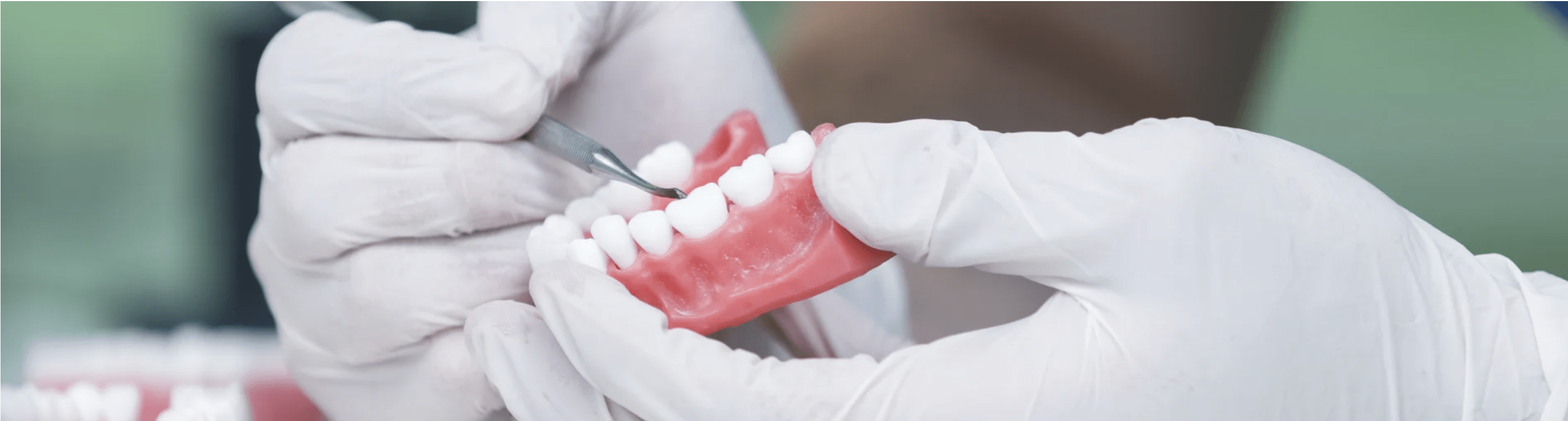 dental implants mingara dental